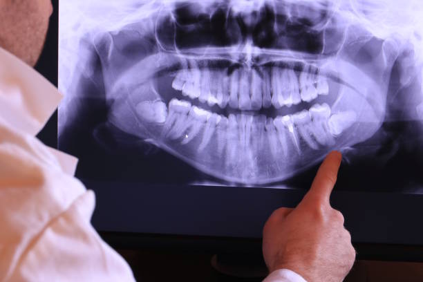 Best Root Canal Emergency Dentist  in Livingston, TX